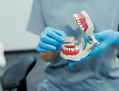 Wat je moet weten over wachttijden bij een orthodontie verzekering